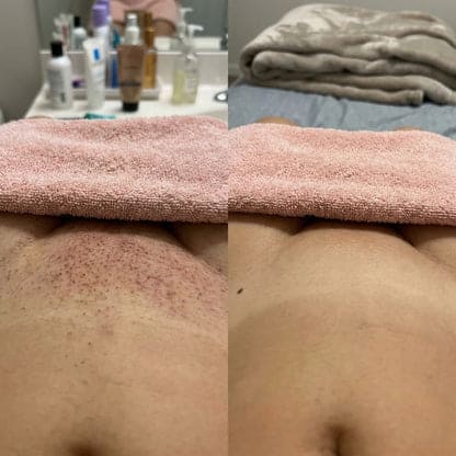 Viareline – Dites adieu aux poils et irritations : Révélez enfin une peau magnifique.