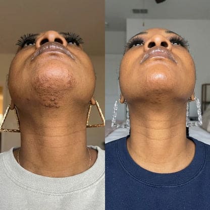 Viareline – Dites adieu aux poils et irritations : Révélez enfin une peau magnifique.